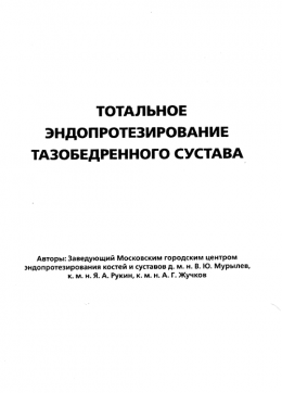 Тотальное эндопротезирование тазобедренного сустава